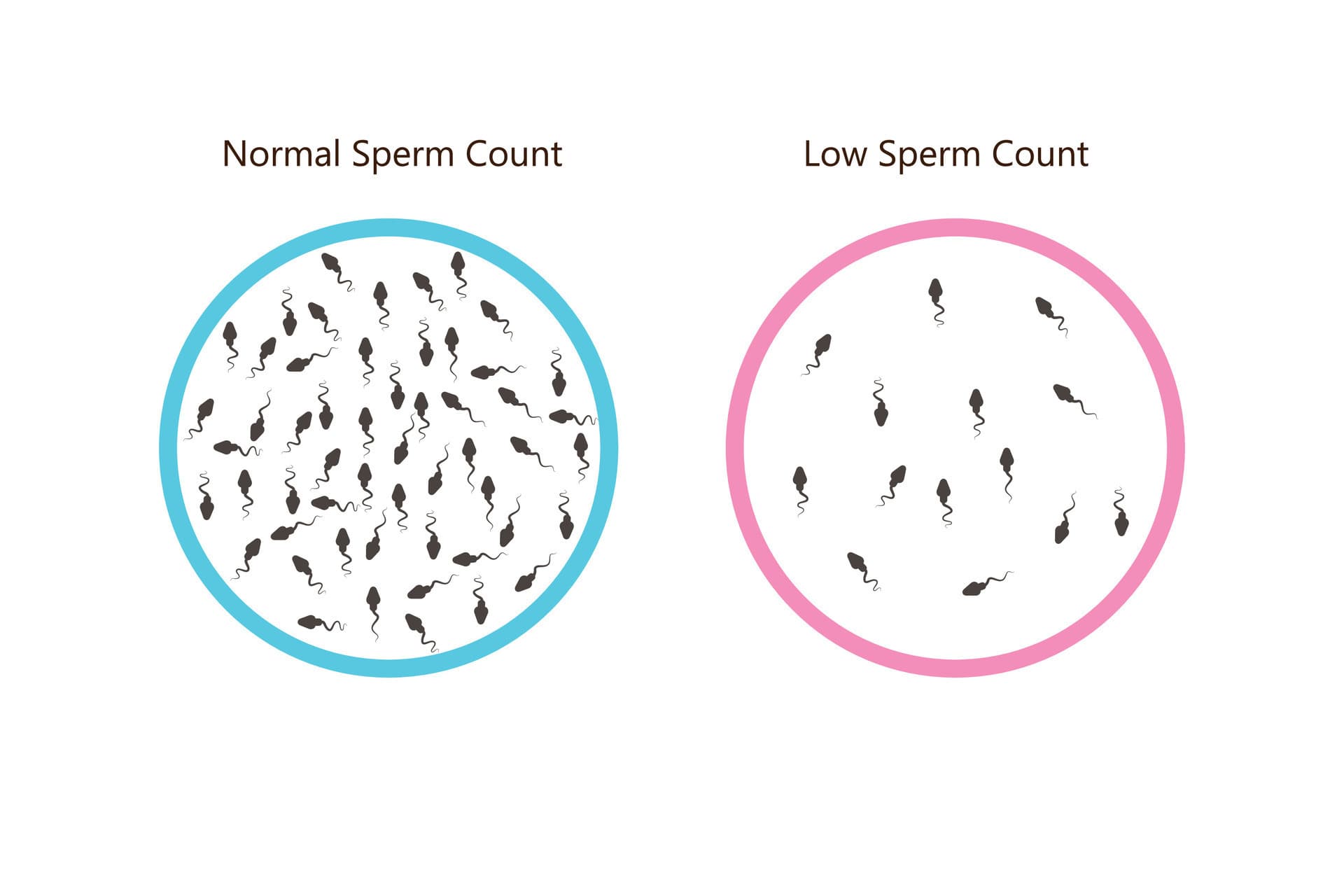 Low Sperm Count - Dr Narasimha Clinic